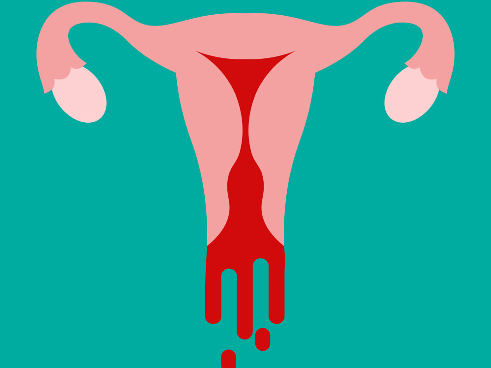Vaginal bleeding during sex
